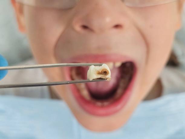 Emergency Dentist for Kids in KY